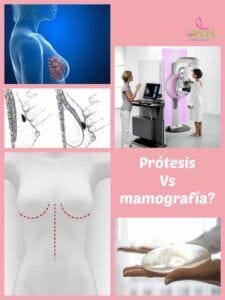 Las mamografías y las prótesis